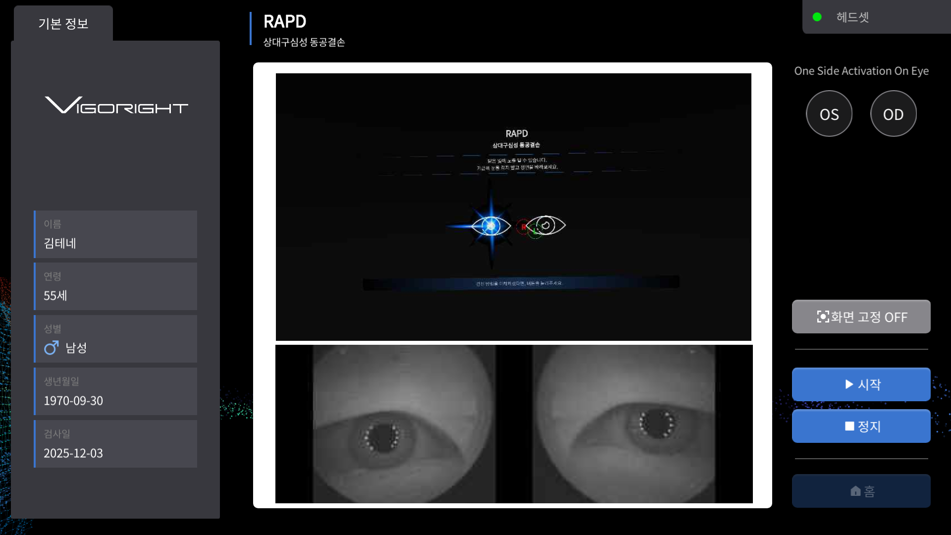 상대구심성 동공결손검사 (RAPD)
VIGORIGHT NEURO 103
